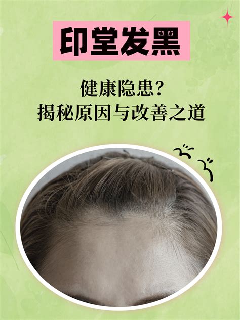 印堂黑|印堂发黑，健康隐患？揭秘原因与改善之道